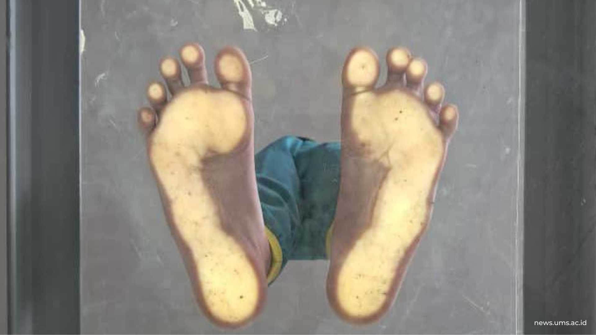 Contoh hasil scan arkus kaki anak